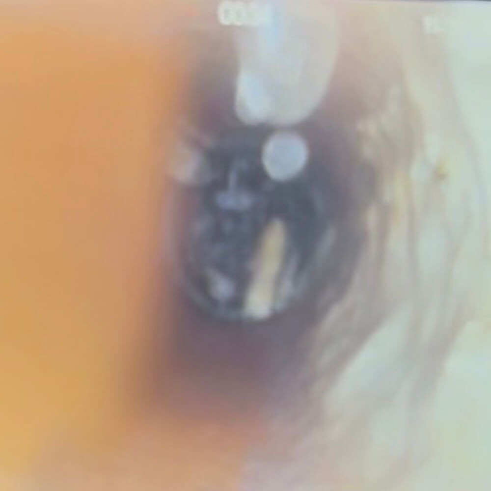before-4